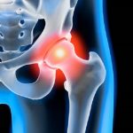 Causes of Hip Flexor Pain