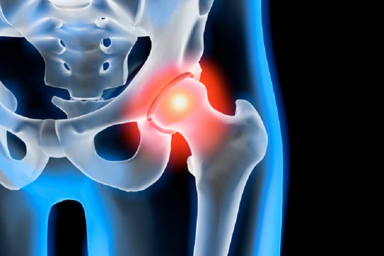 Causes of Hip Flexor Pain