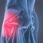 Signs You Have Tight Hip Flexors