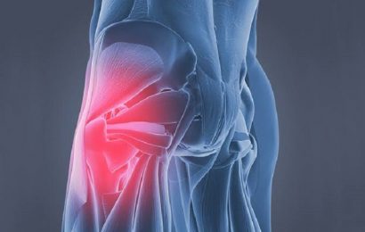 Signs You Have Tight Hip Flexors