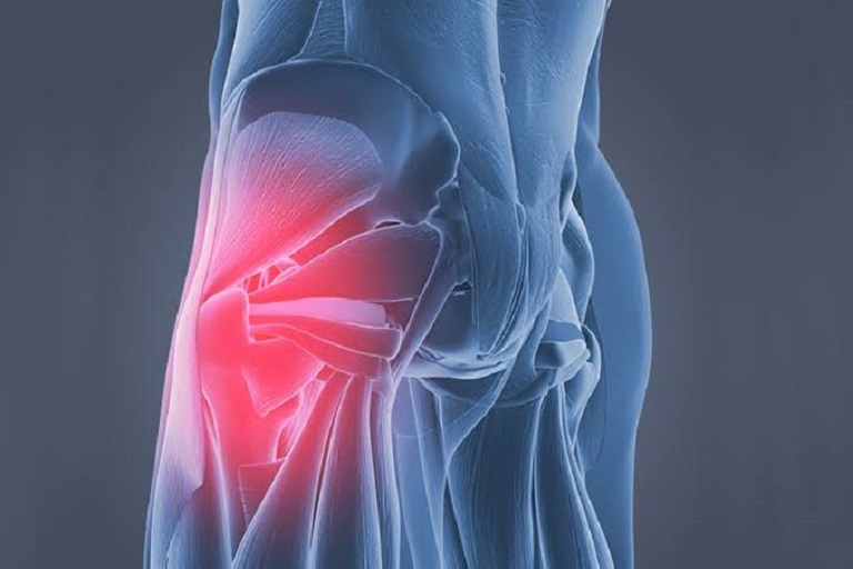 Signs You Have Tight Hip Flexors