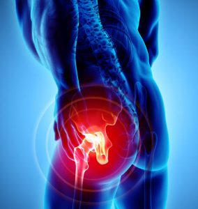 What Causes Tight Hip Flexors